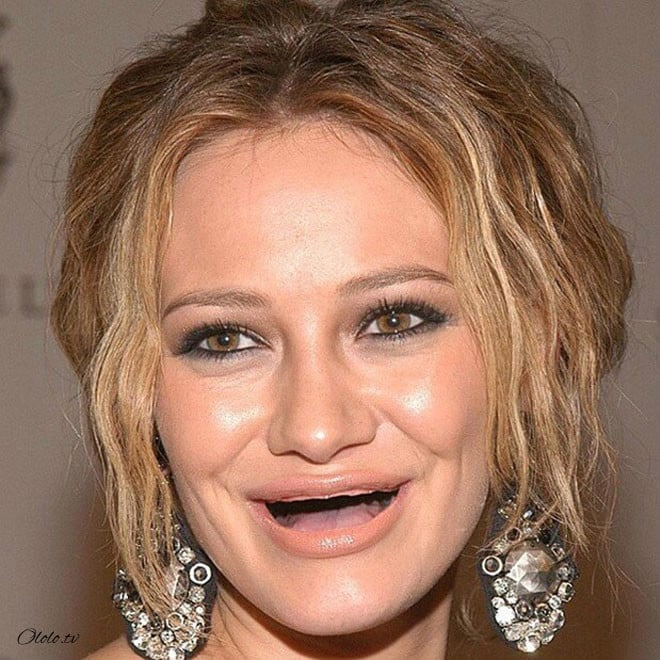 Фотографии голливудских звёзд без зубов, которые реально развеселят вас рис 15