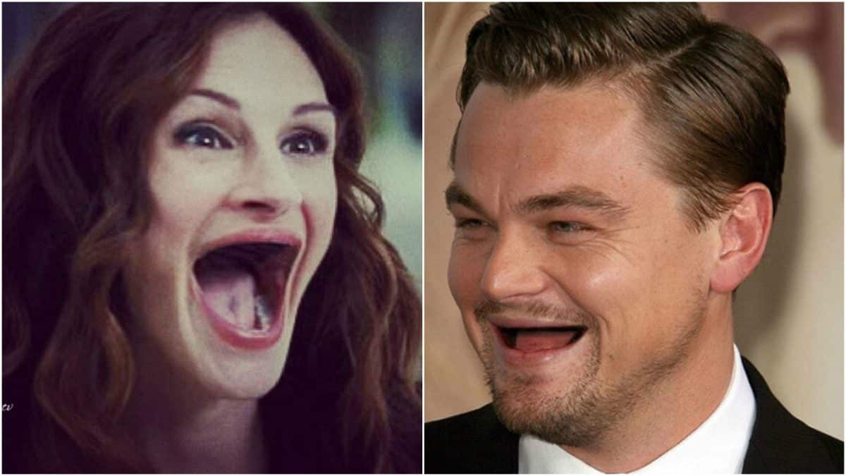 Фотографии голливудских звёзд без зубов, которые реально развеселят вас