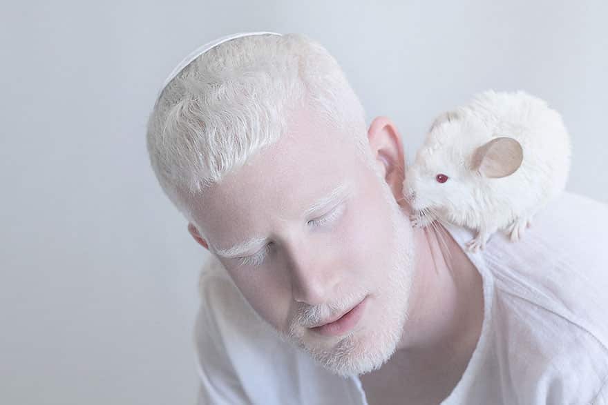 15 людей альбиносов, которые поразят вас своей красотой. рис 5