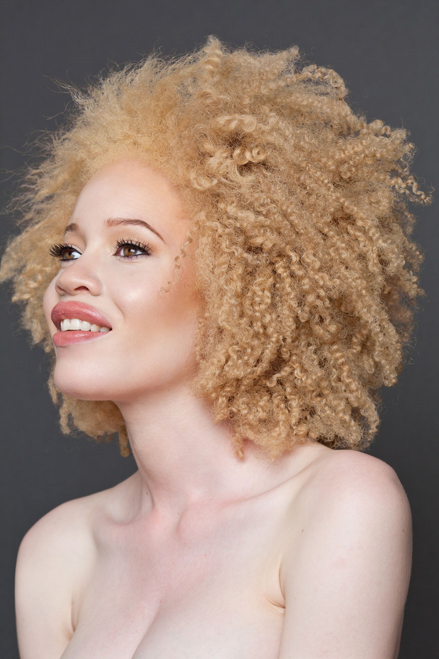 15 людей альбиносов, которые поразят вас своей красотой. рис 8