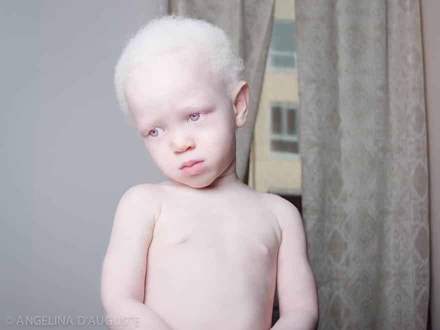15 людей альбиносов, которые поразят вас своей красотой. рис 12