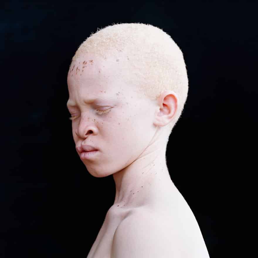 15 людей альбиносов, которые поразят вас своей красотой. рис 13
