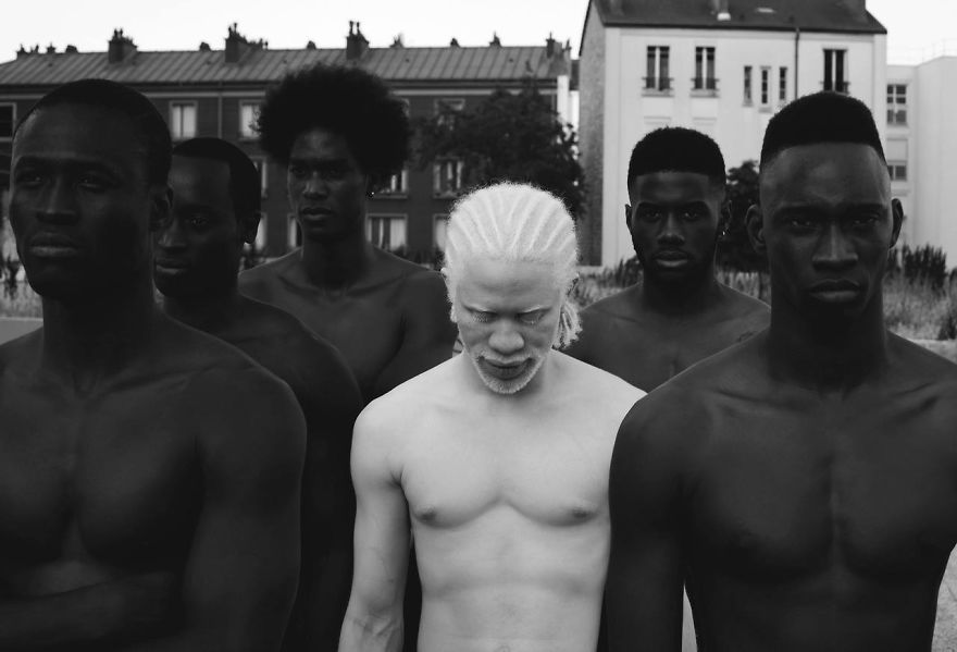 15 людей альбиносов, которые поразят вас своей красотой. рис 3
