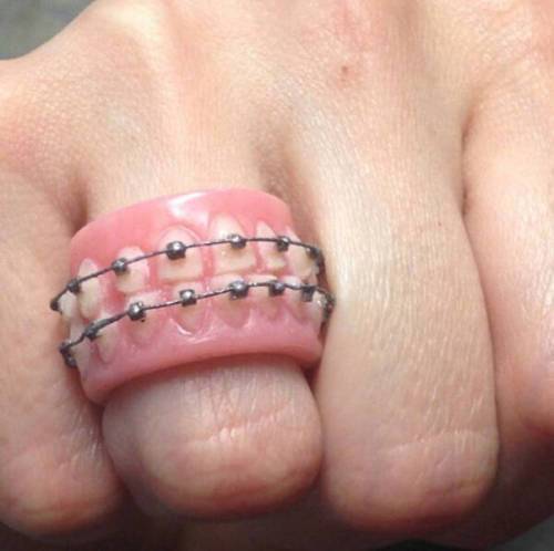 кольцо в виде зубов с брекетами