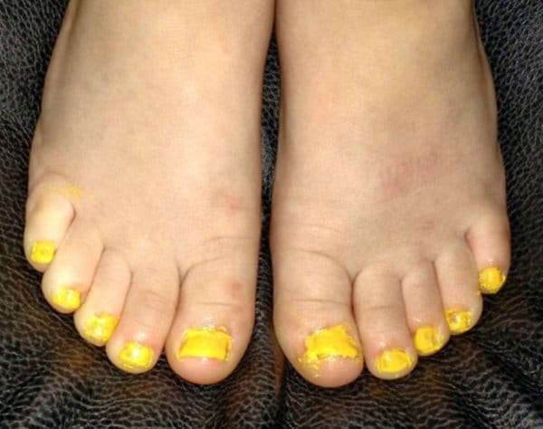 желтый лак на ногтях