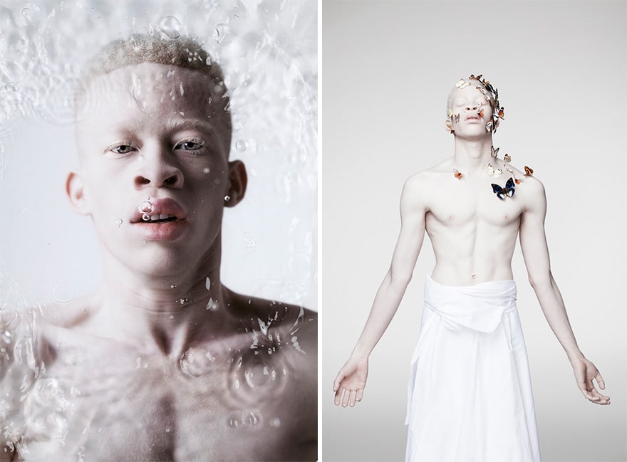 Парень-альбинос художественные фото