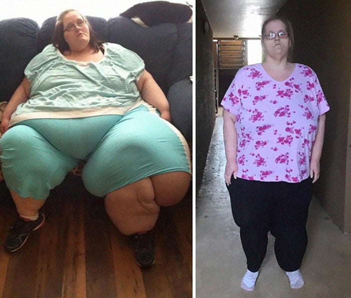Женщина похудела: фото до и после