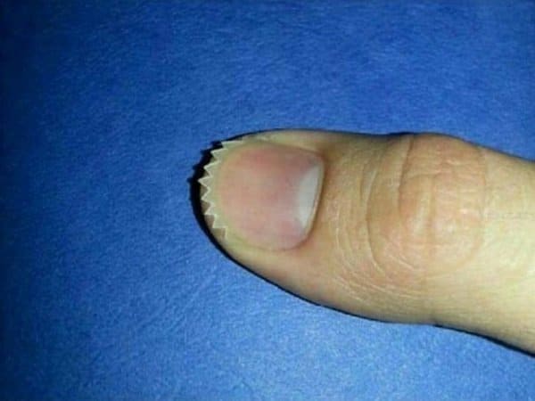 большой палец руки